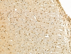 Invitrogen Cyclin A1 Polyclonal Antibody 100 &mu;L; Unconjugated:Antibodies,