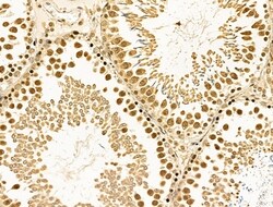 Invitrogen Cyclin A1 Polyclonal Antibody 100 &mu;L; Unconjugated:Antibodies,