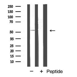 Invitrogen Cyclin A1 Polyclonal Antibody 100 &mu;L; Unconjugated:Antibodies,
