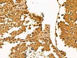 Invitrogen HSPH1 Polyclonal Antibody 100 &mu;L; Unconjugated:Antibodies,