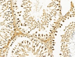 Invitrogen HSPH1 Polyclonal Antibody 100 &mu;L; Unconjugated:Antibodies,