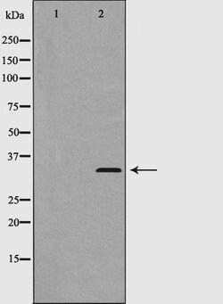 Invitrogen Phospho-Cyclin D2 (Thr280) Polyclonal Antibody 100 &mu;L; Unconjugated:Antibodies,