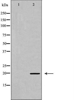 Invitrogen Phospho-MYL9 (Ser19) Polyclonal Antibody 100 &mu;L; Unconjugated:Antibodies,