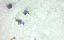 Invitrogen Bcr Polyclonal Antibody 100 &mu;L; Unconjugated:Anticorps, Polyclonal