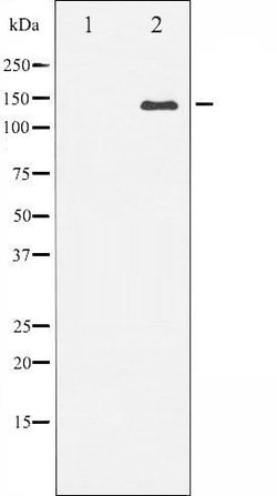Invitrogen Bcr Polyclonal Antibody 100 &mu;L; Unconjugated:Anticorps, Polyclonal