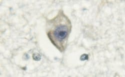 Invitrogen Calmodulin 1/2/3 Polyclonal Antibody 100 &mu;L | Buy Online | Invitrogen&trade; | Fisher Scientific