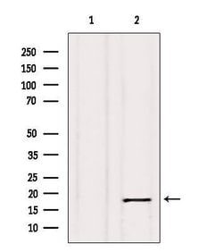 Invitrogen Calmodulin 1/2/3 Polyclonal Antibody 100 &mu;L | Buy Online | Invitrogen&trade; | Fisher Scientific