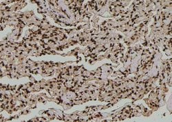 Invitrogen Phospho-SF1 (Ser80, Ser82) Polyclonal Antibody 100 &mu;L | Buy Online | Invitrogen&trade; | Fisher Scientific