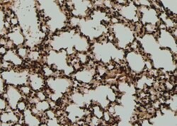 Invitrogen Phospho-SF1 (Ser80, Ser82) Polyclonal Antibody 100 &mu;L | Buy Online | Invitrogen&trade; | Fisher Scientific