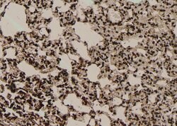 Invitrogen Phospho-SF1 (Ser80, Ser82) Polyclonal Antibody 100 &mu;L | Buy Online | Invitrogen&trade; | Fisher Scientific