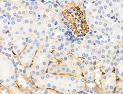 Invitrogen Phospho-MYL2 (Ser15) Polyclonal Antibody 100 &mu;L; Unconjugated:Antibodies,