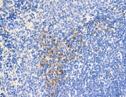 Invitrogen Phospho-MYL2 (Ser15) Polyclonal Antibody 100 &mu;L; Unconjugated:Antibodies,