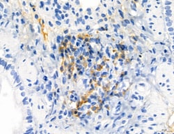Invitrogen Phospho-MYL2 (Ser15) Polyclonal Antibody 100 &mu;L; Unconjugated:Antibodies,