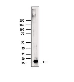 Invitrogen Phospho-MYL2 (Ser15) Polyclonal Antibody 100 &mu;L; Unconjugated:Antibodies,