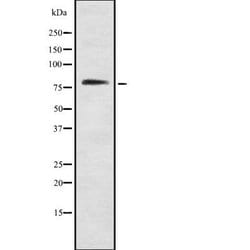 Invitrogen ARHGAP22 Polyclonal Antibody 100 &mu;L | Buy Online | Invitrogen&trade; | Fisher Scientific