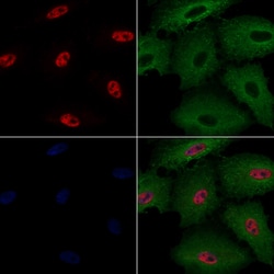 Invitrogen ASF1B Polyclonal Antibody 100 &mu;L; Unconjugated:Antibodies,