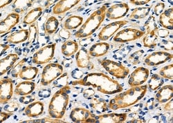Invitrogen TMBIM4 Polyclonal Antibody 100 &mu;L; Unconjugated:Antibodies,