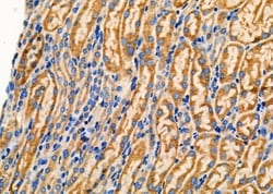 Invitrogen TMBIM4 Polyclonal Antibody 100 &mu;L; Unconjugated:Antibodies,