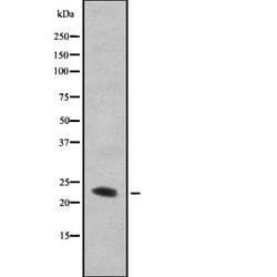 Invitrogen TMBIM4 Polyclonal Antibody 100 &mu;L; Unconjugated:Antibodies,