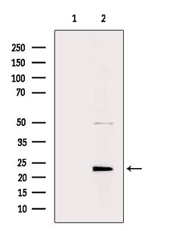 Invitrogen MRPL48 Polyclonal Antibody 100 &mu;L | Buy Online | Invitrogen&trade; | Fisher Scientific