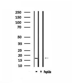 Invitrogen RPS13 Polyclonal Antibody 100 &mu;L; Unconjugated:Antibodies,