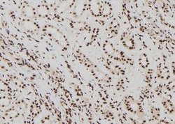Invitrogen ELP2 Polyclonal Antibody 100 &mu;L; Unconjugated:Antibodies,