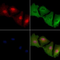 Invitrogen MAGEA12 Polyclonal Antibody 100 &mu;L; Unconjugated:Antibodies,