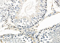 Invitrogen MAGEA12 Polyclonal Antibody 100 &mu;L; Unconjugated:Antibodies,