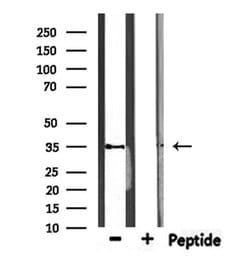 Invitrogen MAGEA12 Polyclonal Antibody 100 &mu;L; Unconjugated:Antibodies,