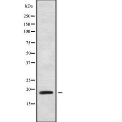 ZNF9 Polyclonal Antibody:Antibodies, Polyclonal