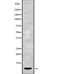 CYP21A2 Polyclonal Antibody, Invitrogen 100 &mu;L; Unconjugated:Antibodies,