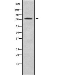 Invitrogen SIK2 Polyclonal Antibody 100 &mu;L; Unconjugated:Anticuerpos