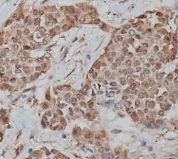 Invitrogen CEACAM8 Polyclonal Antibody 100 &mu;L | Buy Online | Invitrogen&trade; | Fisher Scientific
