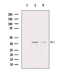 Invitrogen CEACAM8 Polyclonal Antibody 100 &mu;L | Buy Online | Invitrogen&trade; | Fisher Scientific