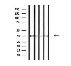 Invitrogen OR4F15 Polyclonal Antibody 100 &mu;L; Unconjugated:Antibodies,