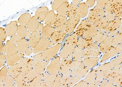 Invitrogen TAS2R50 Polyclonal Antibody 100 μL; Unconjugated:Antibodies,