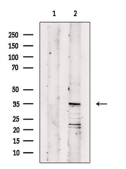 Invitrogen OR11A1 Polyclonal Antibody 100 &mu;L; Unconjugated:Antibodies,