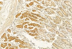 Invitrogen BBS5 Polyclonal Antibody 100 &mu;L; Unconjugated:Antibodies,