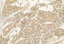 Invitrogen BBS5 Polyclonal Antibody 100 &mu;L; Unconjugated:Antibodies,