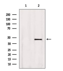 Invitrogen BBS5 Polyclonal Antibody 100 &mu;L; Unconjugated:Antibodies,