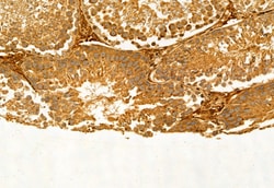 Invitrogen SQLE Polyclonal Antibody 100 &mu;L; Unconjugated:Antibodies,