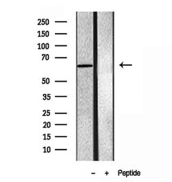 Invitrogen SQLE Polyclonal Antibody 100 &mu;L; Unconjugated:Antibodies,