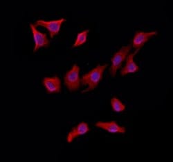 Invitrogen MAT2B Polyclonal Antibody 100 &mu;L; Unconjugated:Antibodies,