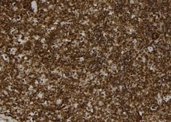 Invitrogen MAT2B Polyclonal Antibody 100 &mu;L; Unconjugated:Antibodies,