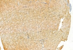 Invitrogen MAT2B Polyclonal Antibody 100 &mu;L; Unconjugated:Antibodies,