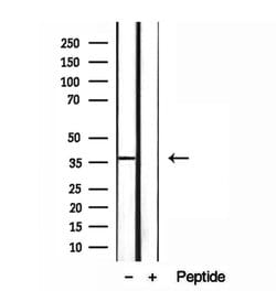 Invitrogen MAT2B Polyclonal Antibody 100 &mu;L; Unconjugated:Antibodies,