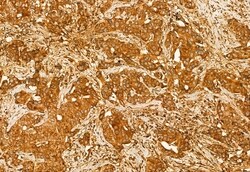 Invitrogen Centrin 1 Polyclonal Antibody 100 &mu;L; Unconjugated:Antibodies,