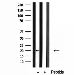 Invitrogen Centrin 1 Polyclonal Antibody 100 &mu;L; Unconjugated:Antibodies,