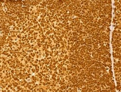 Invitrogen NOB1 Polyclonal Antibody 100 &mu;L; Unconjugated:Antibodies,