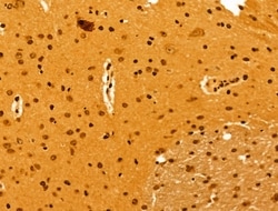 Invitrogen NOB1 Polyclonal Antibody 100 &mu;L; Unconjugated:Antibodies,